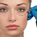 Chirurgia estetica occhi